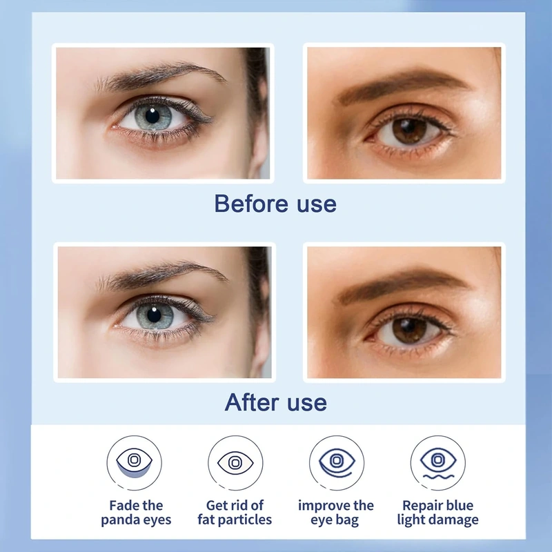 Eye area before and after comparison graphic